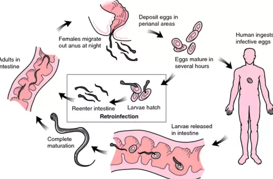 Life Cycle of Enterobiasis